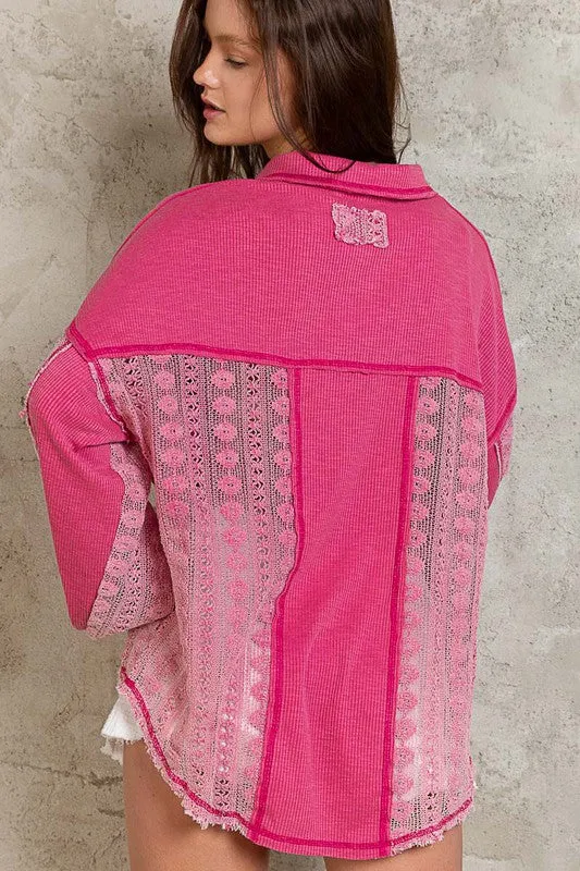 Contrast Lace Top